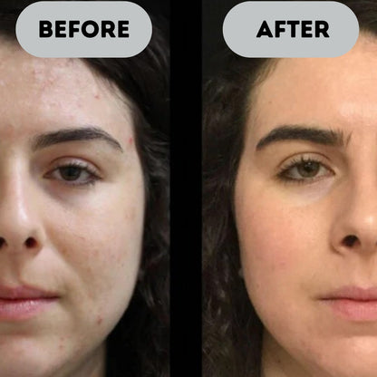 Zoovela™ - Anti-Aging Booster Pro